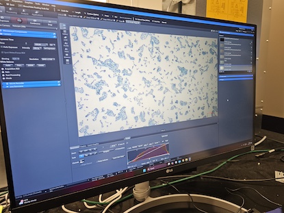 A laboratory computer monitor displays microscope imaging software showing a magnified field of scattered blue-stained cells against a light background. Tool panels with camera settings, exposure controls, and histograms surround the central image, indicating active image analysis in a research lab setting.
