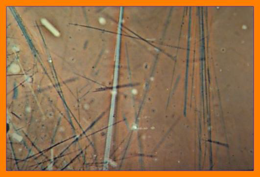 Zoomed in view of asbestos fibers. Shows different size lengths and sizes pointing in different directions.