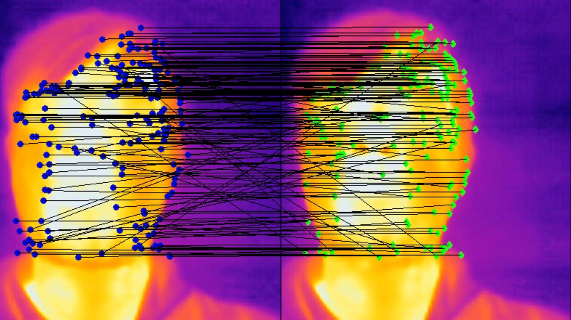 Thermal imaging of human faces.